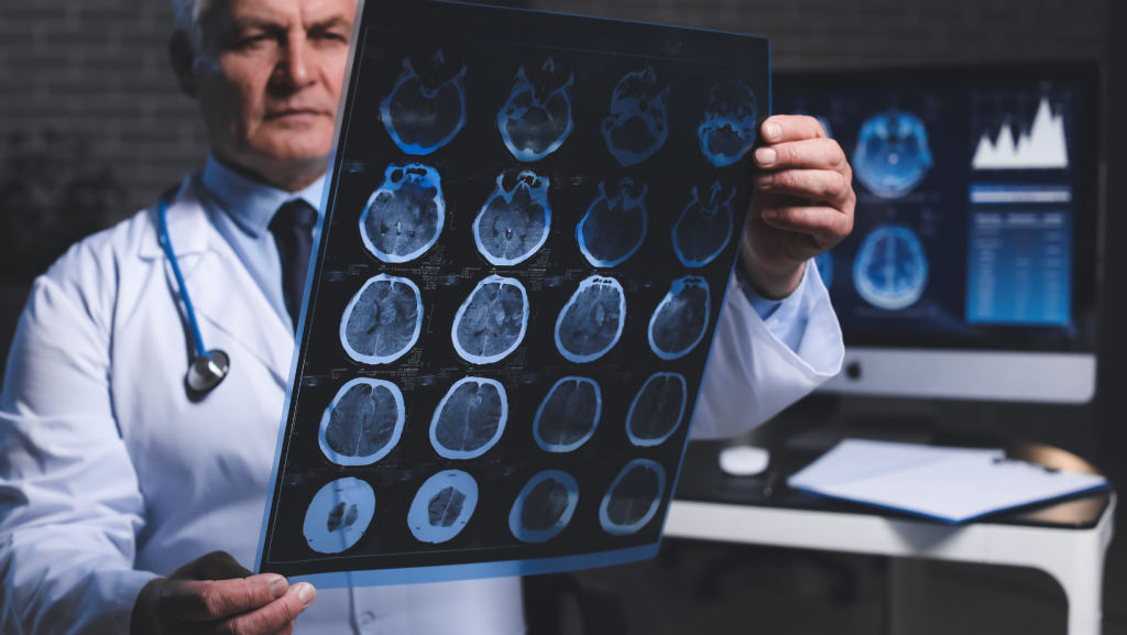 What Does an MRI Show After a Car Accident? 5 Essential Facts You Should Know What does an MRI show after a car accident image of brain scan being reviewed by doctor